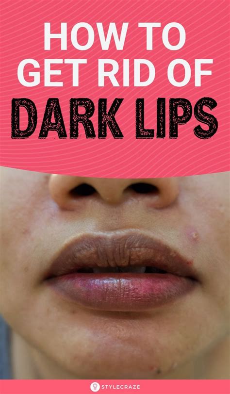 How To Lighten Dark Lips 7 Home Remedies Dark Lips Lips