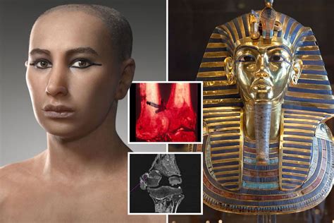How Did Tutankhamun Die King Tuttutankhamun He Was Only 18 When