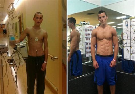 How Inspirational Youtube Star Zach Zeiler Beat Cancer To Become A Bodybuilder With Amazing Abs
