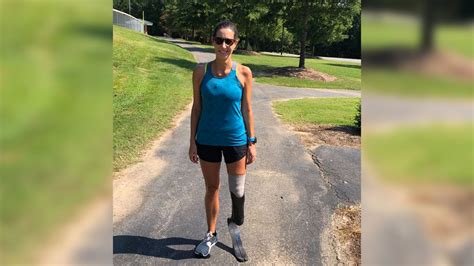 Losing Leg To Cancer Doesnt Slow Down Marathon Running Cary Mom