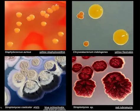 Types Of Bacteria Colonies