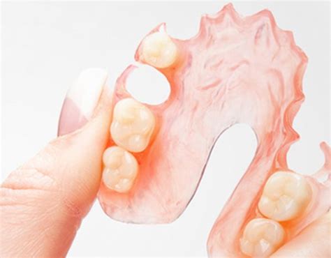 Flexible Partial Denture Dental Lab Direct