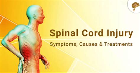 Spinal Cord Injury Symptoms Causes And Treatments Neurogen Bsi
