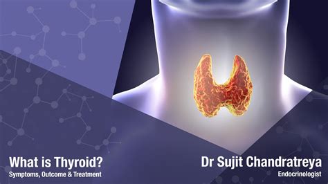 What Is Thyroid Goitre Thyroid Cancer Hypothyroidism