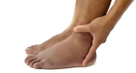 Diabetes Know How To Get Rid Of Swollen Feet Naturally