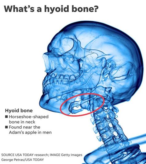 081519 Hyoid Bone Infogram
