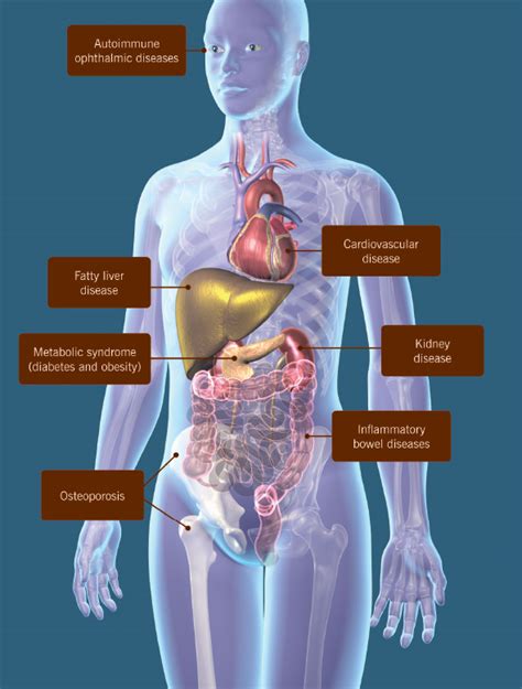 Jorgensen t l, hallas j, friis s., herrstedt j. Guidance at Last on Managing Comorbidities of Psoriatic ...