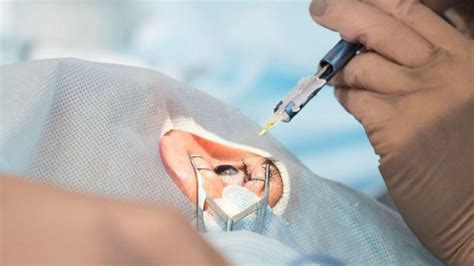 Mata minus abun jauh adalah kelainan cara alami mengobati penyakit katarak pada mata. Biaya Lasik Mata Terbaru Terbaru | Biaya.Info