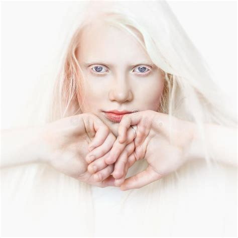 Sexy Naked Albino Girl Telegraph