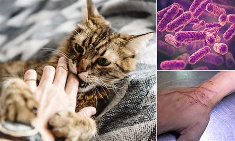 Schizophrenia May Be Linked To Bartonella The Bacteria Behind Cat