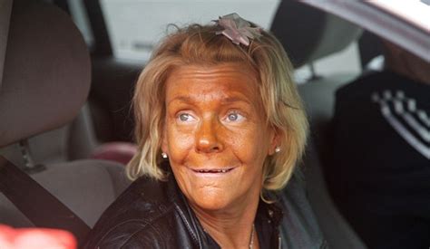 Tanning Mom Attempts To Restore Her Skin As Face Of New Beauty Campaign