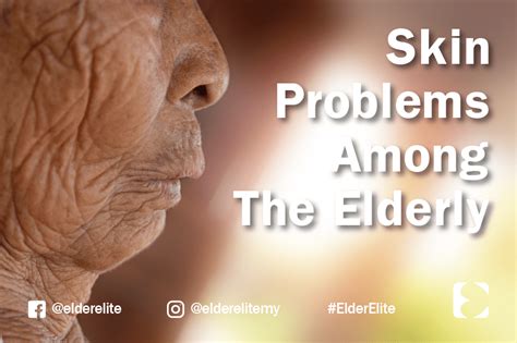Skin Problems Among The Elderly Elder Elite