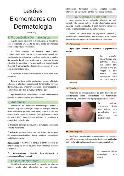 Lesões Elementares Em Dermatologia Lesões Elementares Em Dermatologia Data 10 1