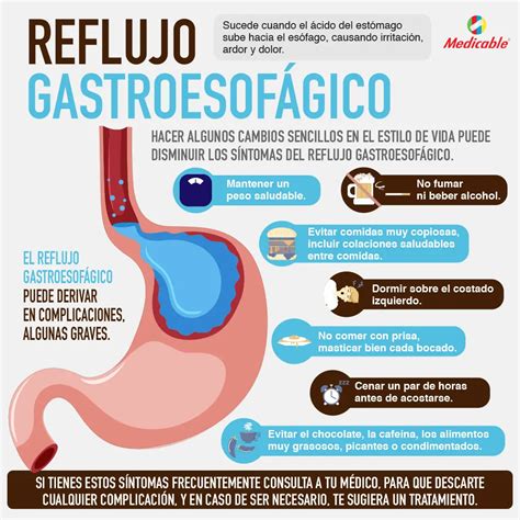 Reflujo Gastroesof Gico Medicable