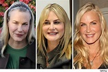 Daryl Hannah Plastic Surgery Gone Wrong Before and After - Star Plastic ...