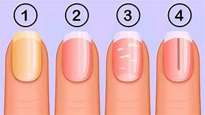 Types Of Nail Color And Health Problems Associated With Them