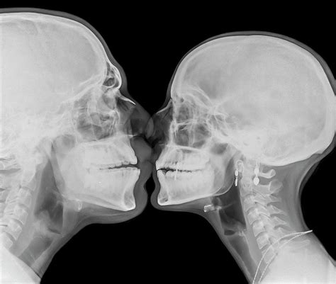 X Ray Kissing Photograph By Photostock Israel Fine Art America