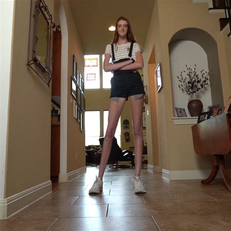 Guinness World Records Says Teen Has The World S Longest Legs You Don