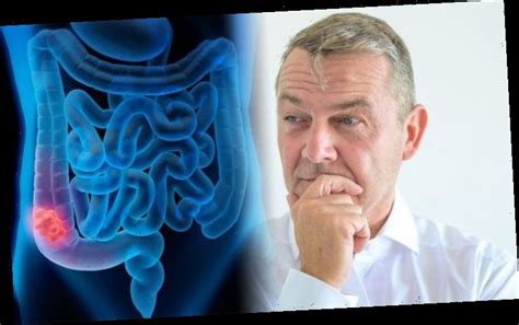 This can cause gangrene to quickly establish in the colon. Bowel cancer symptoms: The signs of the disease to look ...