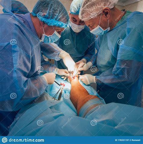Process Of Trauma Surgery Operation Group Of Surgeons In Operating