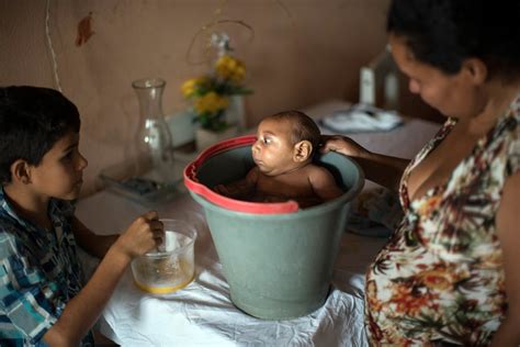 brazil revises birth defect count in zika investigation nbc news