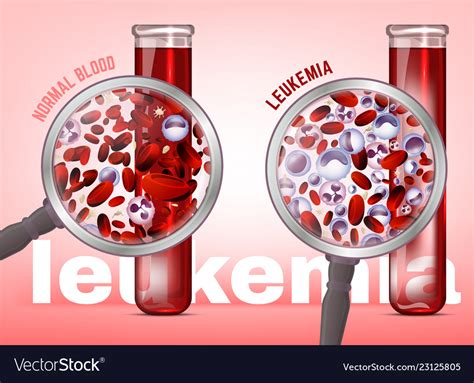 Leukemia Horizontal Background Royalty Free Vector Image