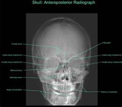 Идеи на тему X ray anatomy 19 радиология анатомия медицина