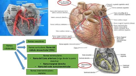Arterias Del Corazon