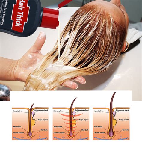 Anti Hair Loss Shampoo Thick Dexe 200ml C1 Hirix