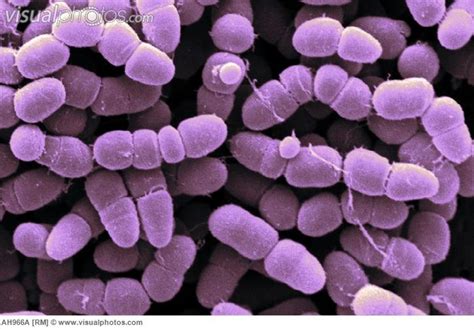 Clostridium Perfringens Gram Positive Rod Bactérias