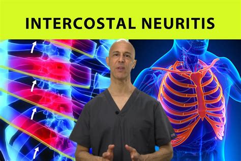 Intercostal Neuritis Relief Mid Back Pain Rib And Chest Pain Dr