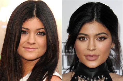 Kylie Jenner Is Unrecognisable In Old Pics Pre Lip Fillers Daily Star