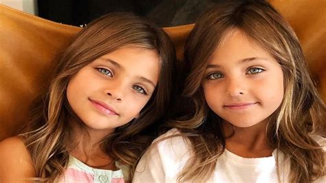 Twins Named Most Beautiful In World Images And Photos Finder