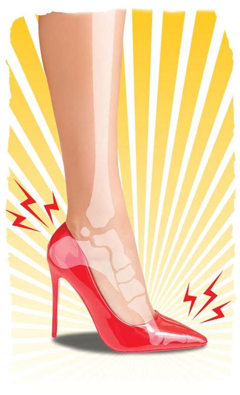 Raising The Risk Of Injury High Heels Can Have Health Effects Far