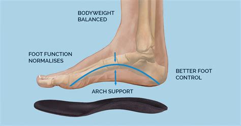 Everything You Need To Know About Arch Pain Mass4d® Insoles Mass4d