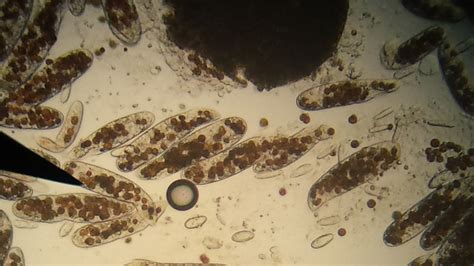 Brown Jelly Disease Under The Microscope Page Hot Sex Picture