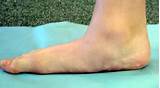 Photos of Foot Flat