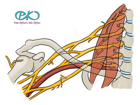 Upper Brachial Plexus Injury