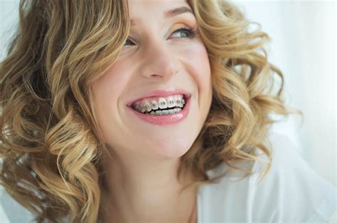 Signs That You Might Need Braces Belmar Orthodontics