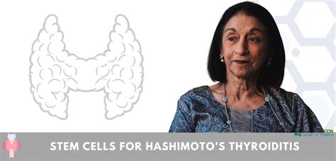 Stem Cell Treatment For Hashimotos Disease And Chronic Thyroiditis