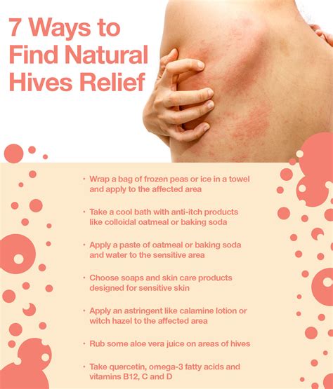 Relief From Hives Urticaria And Eczema Rashes In Unde