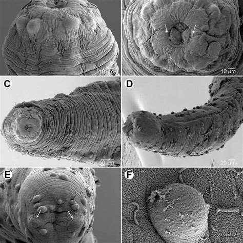 Philometra Cryptocentri Yamaguti 1961 Scanning Electron Micrographs