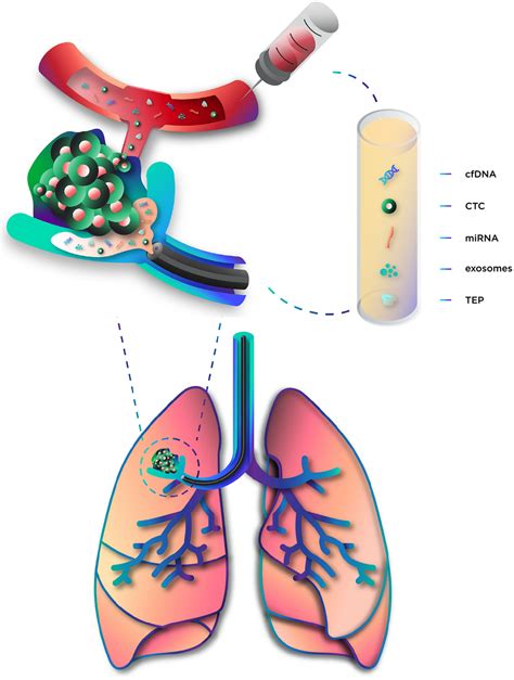 Frontiers The Role Of Liquid Biopsy In Early Diagnosis Of Lung Cancer