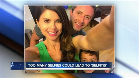 too many selfies could lead to selfitis youtube