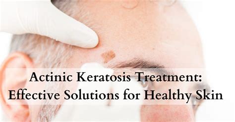 Actinic Keratosis Treatment Effective Solutions For Healthy Skin