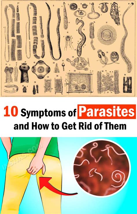 Symptoms Of Parasites And How To Get Rid Of Them Parasites Symptoms Parasite Recurring