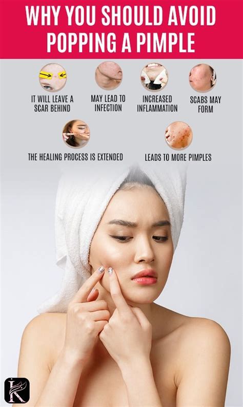 Pin On Skin Care Tips