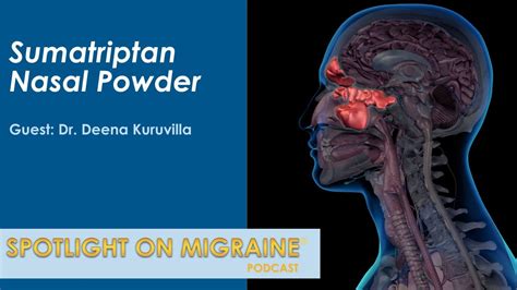 Sumatriptan Nasal Powder For The Acute Treatment Of Migraine