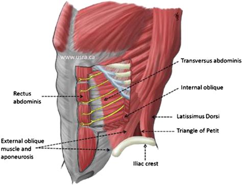 Transversus Abdominis Plane Blocks An Overview Of Indication And