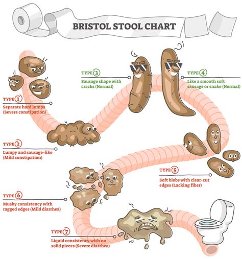The Bristol Stool Chart A Poop Ranking System